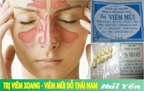 thuốc viêm xoang đỗ thái nam